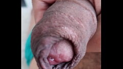 Displaying my uncircumcised cock, extreme closeup. July 18, 2024. Thumb